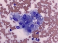 Inflammation