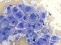 Lipofuscin