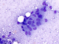 Mesothelial cells