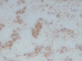Copper (rubeanic stain)