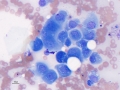 Mesothelial cells