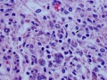 Copper & inflammation (H&E)