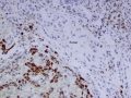 Copper (rubeanic stain)