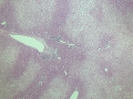 Vacuolar change (histology)