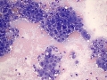 Vacuolar change (lipid)