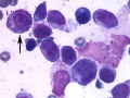Mast cell tumor (DQ)