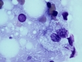 Mycobacteria