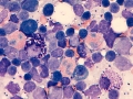 Eosinophils