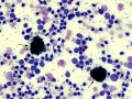 Melanophages