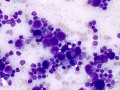 Mast cell tumor (cat)