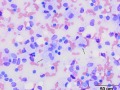 Mast cell tumor (cat)