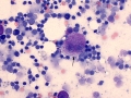 Binucleated mast cell