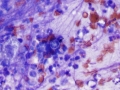 Blastomyces