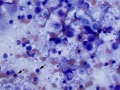 Cryptococcus