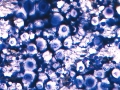 Cryptococcus