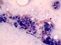 Eosinophils