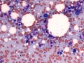 Eosinophils