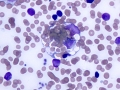 Erythrophage