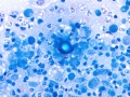 Coccidioides
