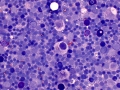 Lymphophage