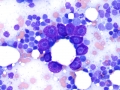 Mast cell tumor