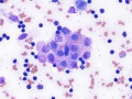 Mast cell tumor