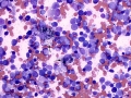 Melanophages