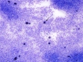 Melanophages