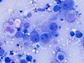Metastatic carcinoma (cat)
