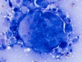 Metastatic carcinoma (cat)