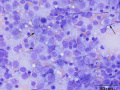 Metastatic nasal lymphoma (cat)