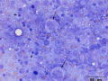 Metastatic nasal lymphoma (cat)