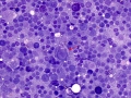 Lymphophage