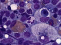 Neorickettsia