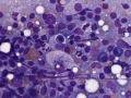 Neorickettsia