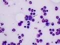 Eosinophils