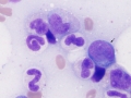 B lymphoma (dog)