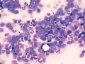 B lymphoma (dog)