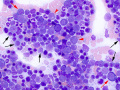 GL lymphoma (dog)