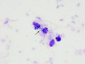 Semen