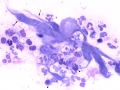 Bacterial sinusitis (horse)