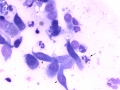 Bacterial sinusitis (horse)