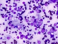 Lymphoma (dog)