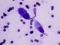 Columnar & goblet cell