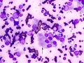 Lymphoma (dog)