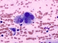 Sarcoma (cat)