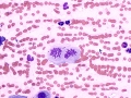 Sarcoma (cat)