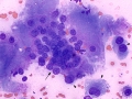 Sarcoma (cat)