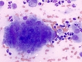 Sarcoma (cat)