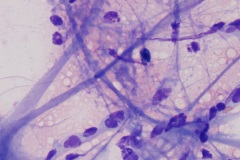 Neural tissue